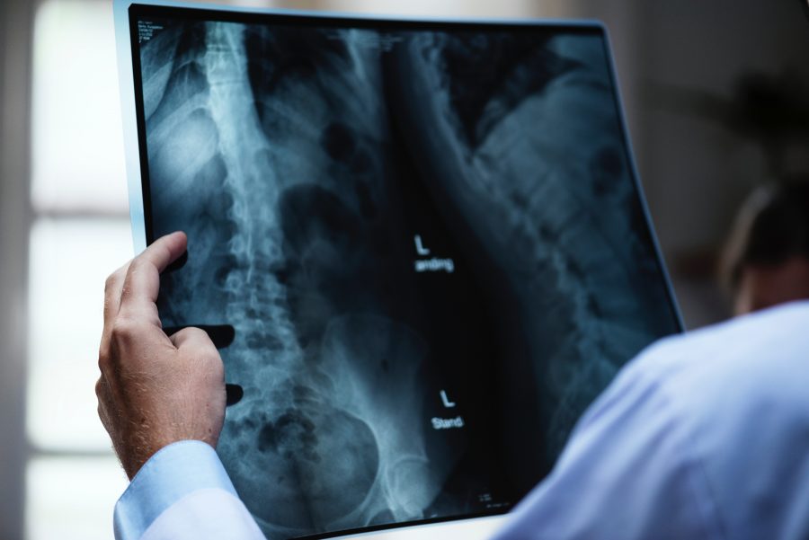 Spinal xray -Portugal Chiropractic in Lake Forest